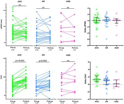 Cardiovascular Risk Factors and Hemodynamic Measures as Determinants of Increased Arterial Stiffness Following Surgical Aortic Valve Replacement